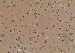 Phospho-p53 (Tyr327) Antibody in Immunohistochemistry (Paraffin) (IHC (P))