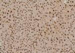 Phospho-p53 (Tyr327) Antibody in Immunohistochemistry (Paraffin) (IHC (P))