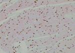 Phospho-p53 (Tyr327) Antibody in Immunohistochemistry (Paraffin) (IHC (P))