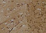 Phospho-ITGB1 (Tyr795) Antibody in Immunohistochemistry (Paraffin) (IHC (P))