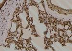 Phospho-ITGB1 (Tyr795) Antibody in Immunohistochemistry (Paraffin) (IHC (P))