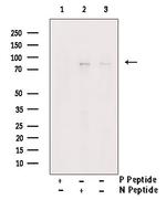 Phospho-PKC beta-1 (Thr642, Thr644) Antibody in Western Blot (WB)