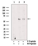 Phospho-LCK (Tyr505) Antibody in Western Blot (WB)