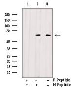 Phospho-Fyn (Tyr213, Tyr214) Antibody in Western Blot (WB)