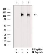 Phospho-ATP1A1 (Tyr260) Antibody in Western Blot (WB)