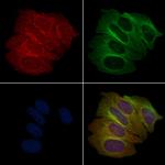 Phospho-eIF4E (Thr210) Antibody in Immunocytochemistry (ICC/IF)