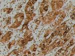 Phospho-eIF4E (Thr210) Antibody in Immunohistochemistry (Paraffin) (IHC (P))