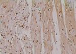 Phospho-eIF4E (Thr210) Antibody in Immunohistochemistry (Paraffin) (IHC (P))