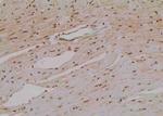 Phospho-eIF4E (Thr210) Antibody in Immunohistochemistry (Paraffin) (IHC (P))