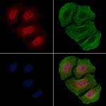 Phospho-NPM1 (Ser10) Antibody in Immunocytochemistry (ICC/IF)