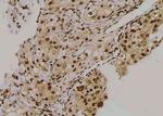 Phospho-beta-2 Adrenergic Receptor (Thr68) Antibody in Immunohistochemistry (Paraffin) (IHC (P))