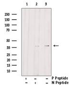 Phospho-beta-2 Adrenergic Receptor (Thr68) Antibody in Western Blot (WB)