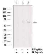 Phospho-Lyn (Tyr193) Antibody in Western Blot (WB)