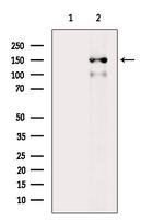 Phospho-BCR (Tyr852) Antibody in Western Blot (WB)