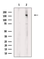 Phospho-BCR (Tyr852) Antibody in Western Blot (WB)