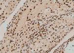 Phospho-BCR (Tyr852) Antibody in Immunohistochemistry (Paraffin) (IHC (P))