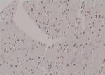 Phospho-BCR (Tyr852) Antibody in Immunohistochemistry (Paraffin) (IHC (P))