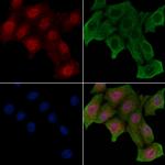 Phospho-CFTR (Thr1471) Antibody in Immunocytochemistry (ICC/IF)