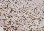 Phospho-CFTR (Thr1471) Antibody in Immunohistochemistry (Paraffin) (IHC (P))