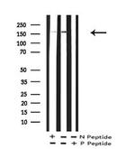 Phospho-CFTR (Thr1471) Antibody in Western Blot (WB)