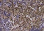 Phospho-EEF2 (Thr57) Antibody in Immunohistochemistry (Paraffin) (IHC (P))