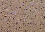 Phospho-EEF2 (Thr57) Antibody in Immunohistochemistry (Paraffin) (IHC (P))