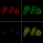 Phospho-L-Plastin (Tyr300) Antibody in Immunocytochemistry (ICC/IF)