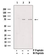 Phospho-L-Plastin (Tyr300) Antibody in Western Blot (WB)