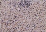 Phospho-GYS1 (Tyr44) Antibody in Immunohistochemistry (Paraffin) (IHC (P))