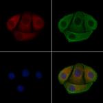 Phospho-p47phox (Ser304) Antibody in Immunocytochemistry (ICC/IF)