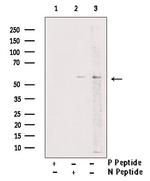 Phospho-PKM2 (Tyr83) Antibody in Western Blot (WB)