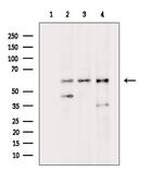 Phospho-PKM2 (Tyr370) Antibody in Western Blot (WB)