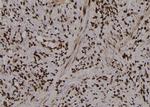 Phospho-PKM2 (Tyr370) Antibody in Immunohistochemistry (Paraffin) (IHC (P))