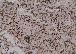 Phospho-PKM2 (Tyr370) Antibody in Immunohistochemistry (Paraffin) (IHC (P))