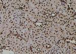 Phospho-PKM2 (Tyr370) Antibody in Immunohistochemistry (Paraffin) (IHC (P))