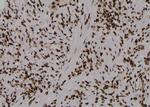 Phospho-PKM2 (Ser148) Antibody in Immunohistochemistry (Paraffin) (IHC (P))