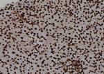 Phospho-PKM2 (Ser148) Antibody in Immunohistochemistry (Paraffin) (IHC (P))