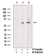 Phospho-PKM2 (Ser148) Antibody in Western Blot (WB)