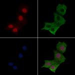 Phospho-MYOD (Thr115) Antibody in Immunocytochemistry (ICC/IF)