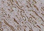 Phospho-MYOD (Thr115) Antibody in Immunohistochemistry (Paraffin) (IHC (P))