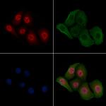 Phospho-Fra1 (Thr227) Antibody in Immunocytochemistry (ICC/IF)