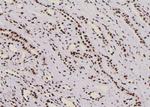 Phospho-Fra1 (Thr227) Antibody in Immunohistochemistry (Paraffin) (IHC (P))