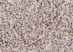 Phospho-Fra1 (Thr227) Antibody in Immunohistochemistry (Paraffin) (IHC (P))