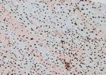 Phospho-Fra1 (Thr227) Antibody in Immunohistochemistry (Paraffin) (IHC (P))