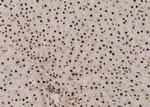 Phospho-Fra1 (Thr227) Antibody in Immunohistochemistry (Paraffin) (IHC (P))