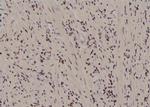 Phospho-FER (Tyr497) Antibody in Immunohistochemistry (Paraffin) (IHC (P))