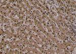 Phospho-PLCG2 (Tyr1245) Antibody in Immunohistochemistry (Paraffin) (IHC (P))