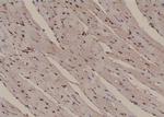 Phospho-PLCG2 (Tyr1245) Antibody in Immunohistochemistry (Paraffin) (IHC (P))