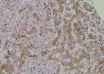 Phospho-PKC alpha (Tyr365) Antibody in Immunohistochemistry (Paraffin) (IHC (P))