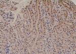 Phospho-PKC alpha (Tyr365) Antibody in Immunohistochemistry (Paraffin) (IHC (P))